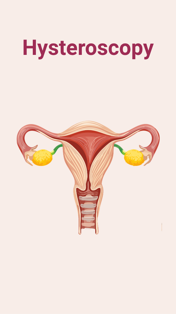 Hysteroscopy at Kimaya
