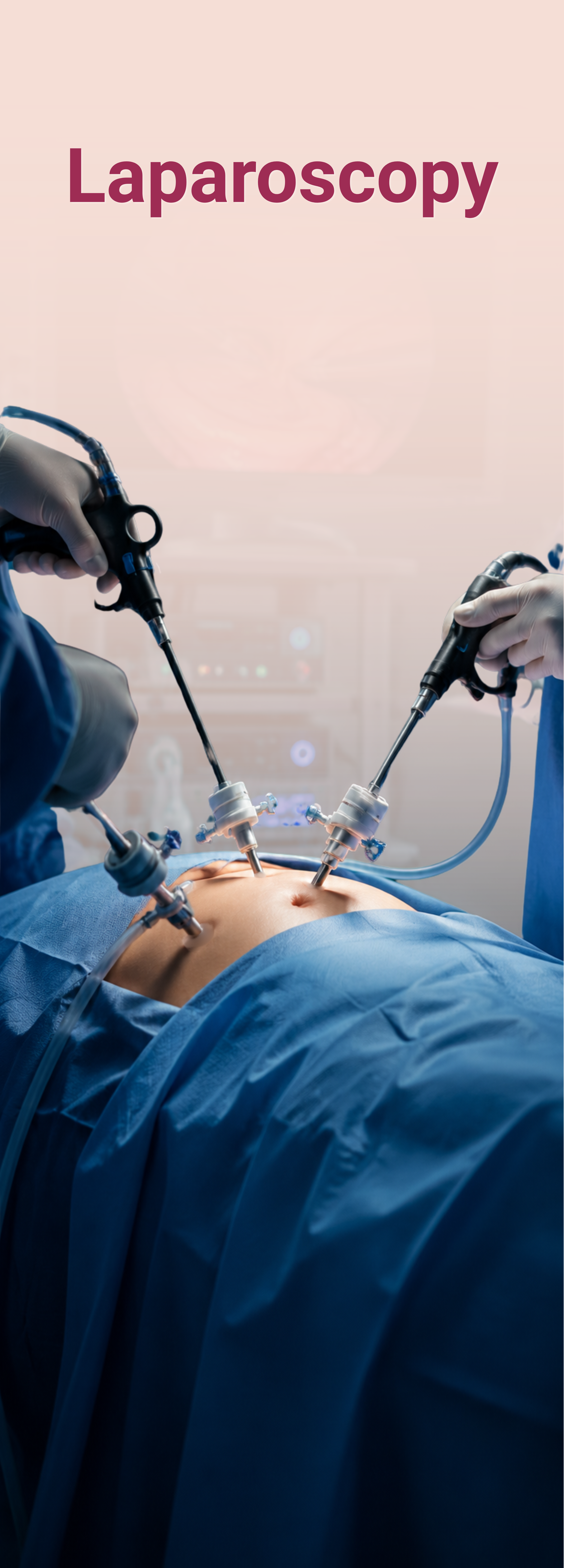 Laparoscopy at Kimaya